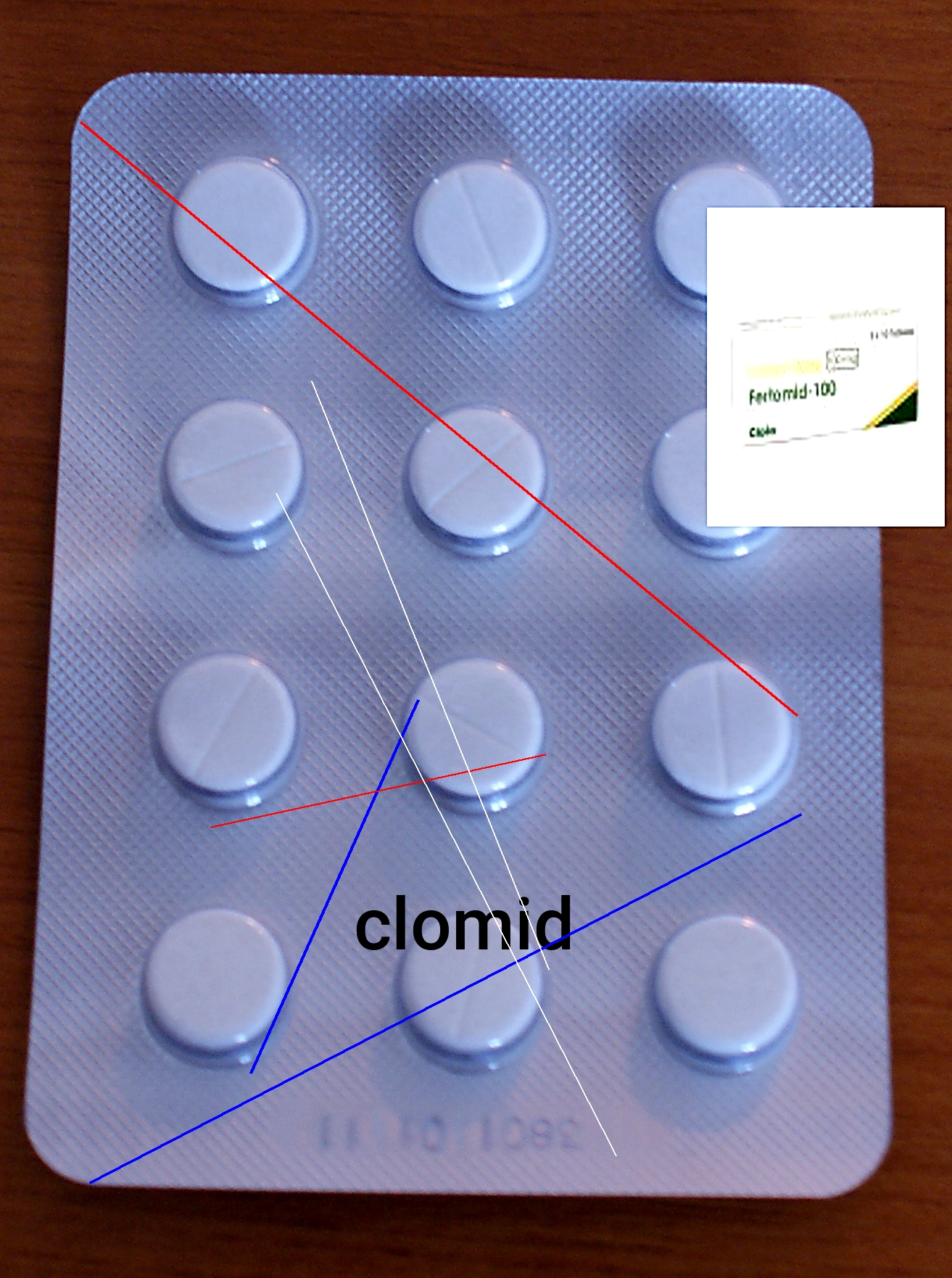 Prix du clomid en belgique